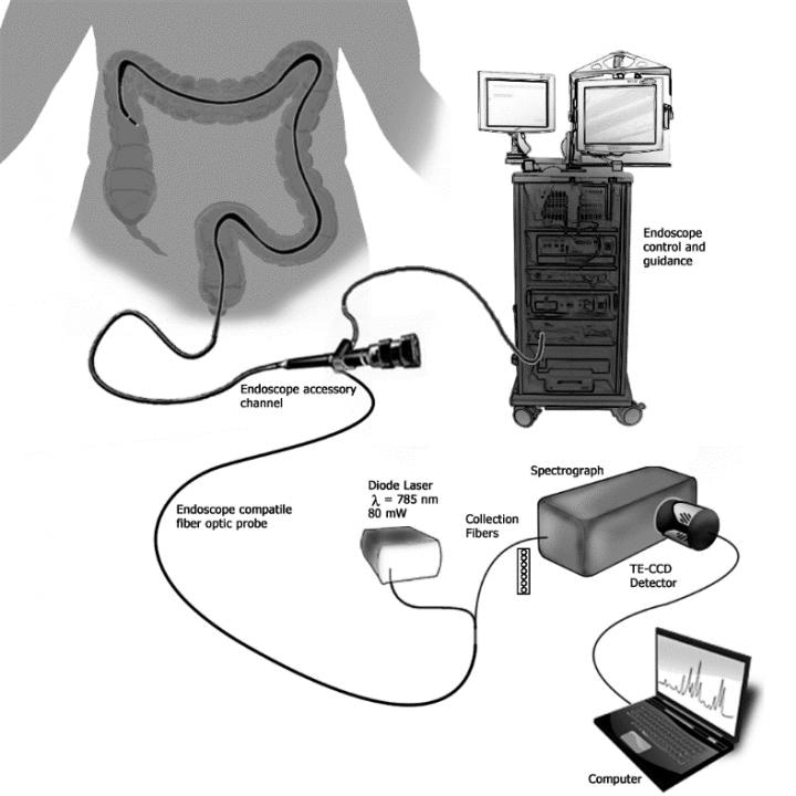 New Sensor Could Fill Major Gap In IBD Diagnosis And Treatment